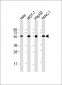 PDIA1 Antibody [Knockout Validated]